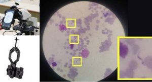 Read more about the article Técnica baseada em inteligência artificial detecta a doença de Chagas usando imagens de celular