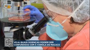 Read more about the article Pesquisadores brasileiros concluem primeira etapa para combater a varíola do macaco