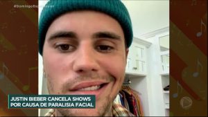 Read more about the article Especialistas explicam a doença que afastou Justin Bieber dos palcos