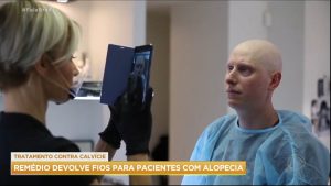 Read more about the article Remédio para tratar alopecia é aprovado nos EUA