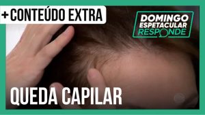 Read more about the article Quantos fios de cabelo é normal perder por dia? Especialista tira dúvidas | DE Responde