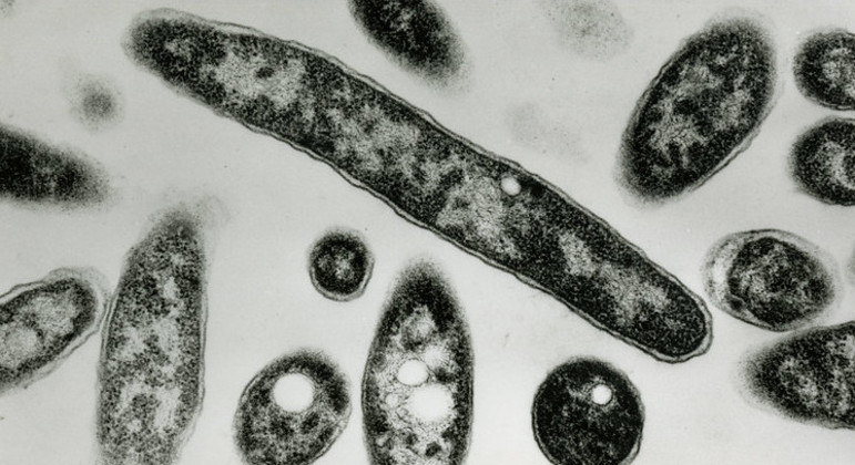 You are currently viewing Argentina chega a seis mortos em surto de pneumonia causada pela bactéria legionella