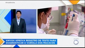 Read more about the article Anvisa aprova primeiro kit para diagnosticar a varíola dos macacos