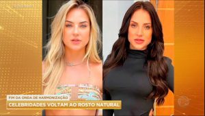 Read more about the article Celebridades revertem harmonização facial em busca de traços naturais