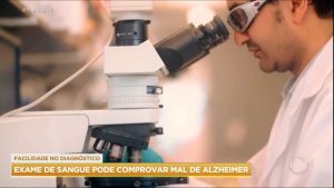 Read more about the article Exame de sangue pode diagnosticar Alzheimer em estágio inicial