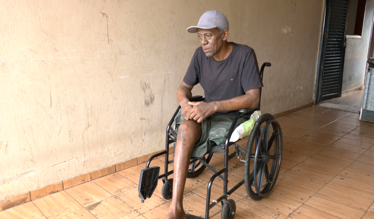 You are currently viewing Atropelado na mesa do bar, homem que teve perna amputada tem alta hospitalar