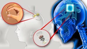 Read more about the article Neuralink: Elon Musk procura voluntários para implantar chip no cérebro