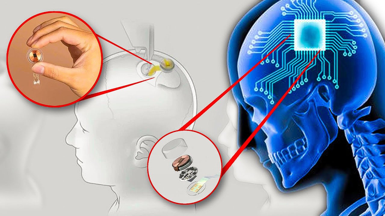 You are currently viewing Neuralink: Elon Musk procura voluntários para implantar chip no cérebro