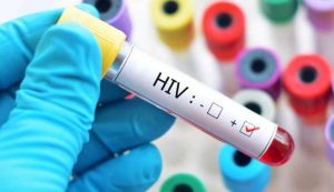 Read more about the article Brasil possui mais de um milhão de pessoas portadoras do vírus HIV, diz Ministério da Saúde